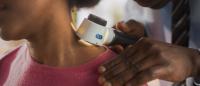 doctor checking patient's neck with dermatology magnifier